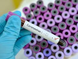 В мире количество заболевших коронавирусом приближается к 25 миллионам