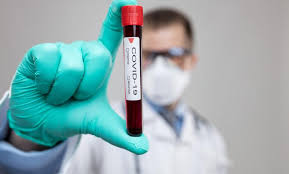Ещё одна страна ЕС проведет бесплатное тестирование всего населения на коронавирус