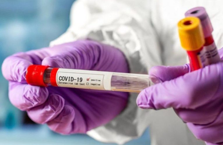 Медики выяснили, сколько дней остаются заразными переболевшие коронавирусом
