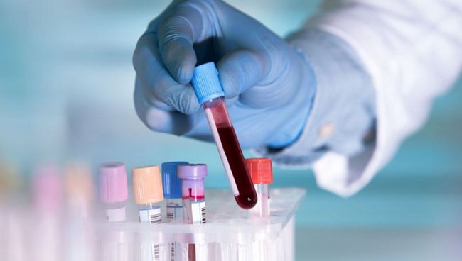 Медики установили связь между группой крови и опасными заболеваниями