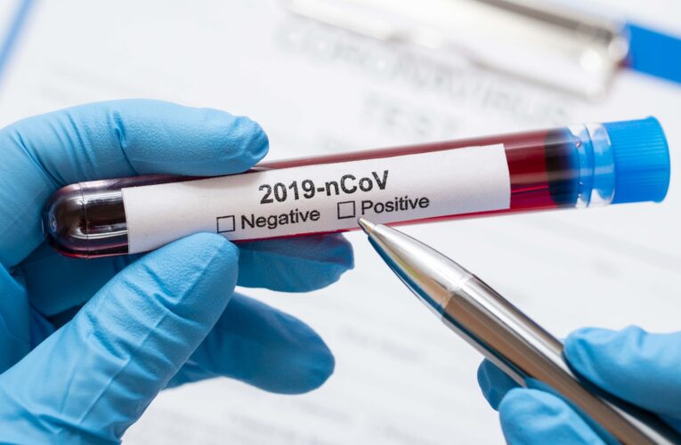 Эксперты спрогнозировали, когда Украина выйдет на пик эпидемии коронавируса