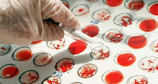 Медики назвали группу крови, обладатели которой уязвимы перед опасными заболеваниями